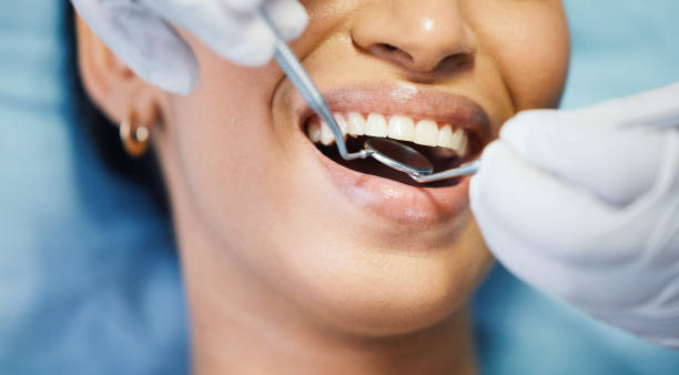 Best Broken or Chipped Tooth Repair in Rogersville, TN