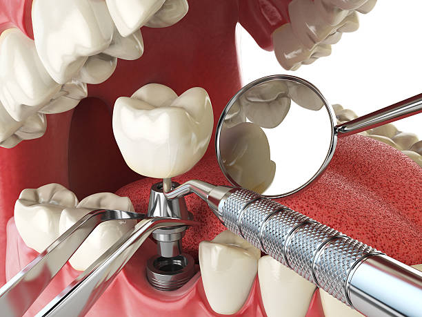 Best Emergency Treatment for Oral Infections in Rogersville, TN